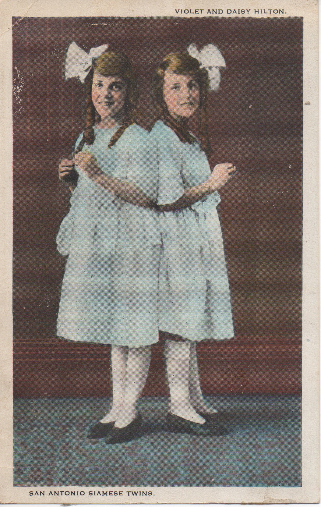 Violet and Daisy Hilton circa 1922